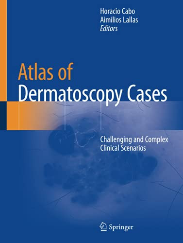 Atlas Of Dermatoscopy Cases: Challenging And Complex Clinical Scenarios