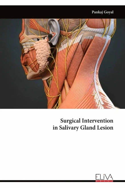 Surgical Intervention In Salivary Gland Lesion