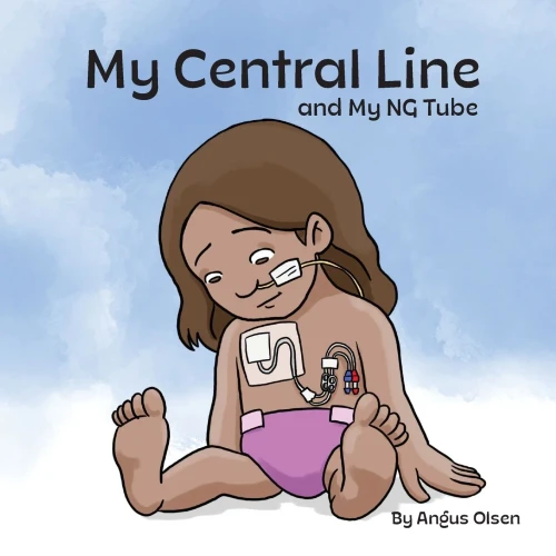 My Central Line And My Ng Tube