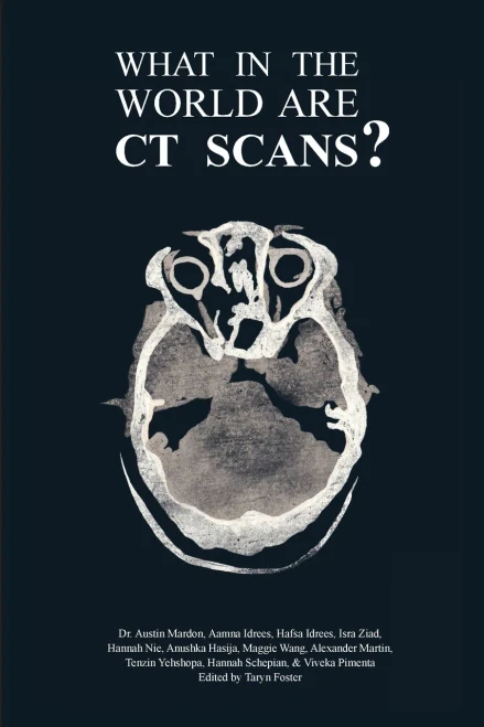 What In The World Are Ct Scans?