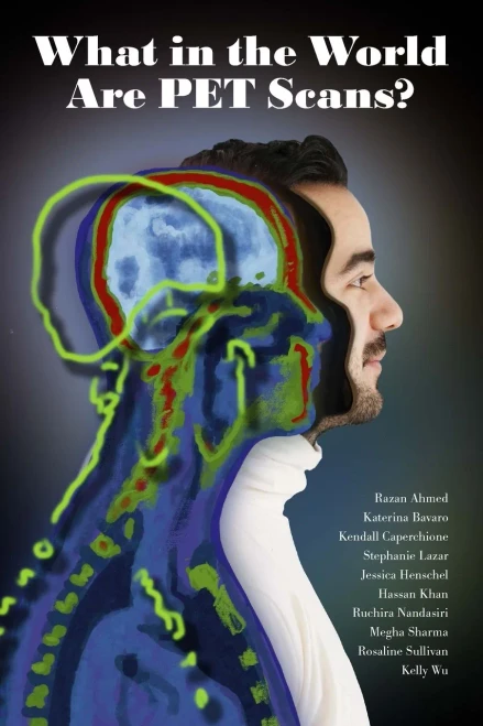 What In The World Are Pet Scans?