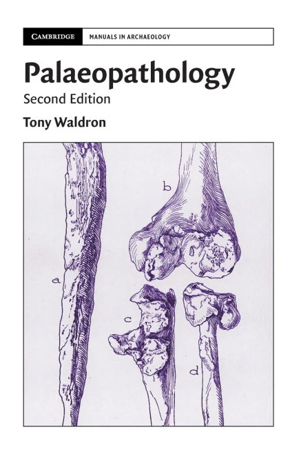 Palaeopathology (Cambridge Manuals In Archaeology) - 9781108499583