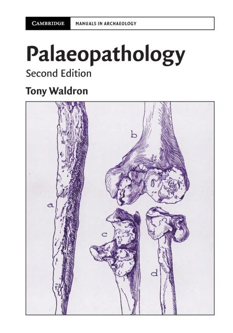 Palaeopathology (Cambridge Manuals In Archaeology) - 9781108730884