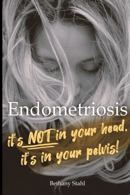 Endometriosis: it's not in your head, it's in your pelvis