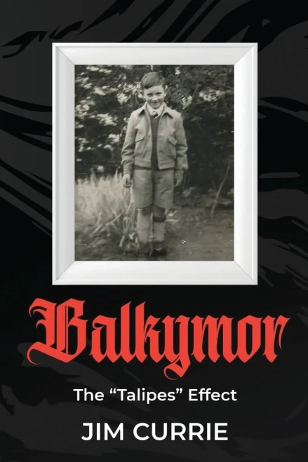 Balkymor: The Talipes Effect