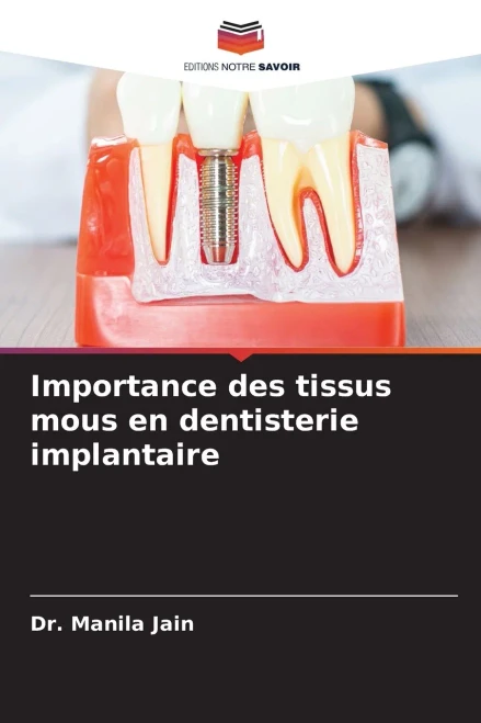 Importance des tissus mous en dentisterie implantaire