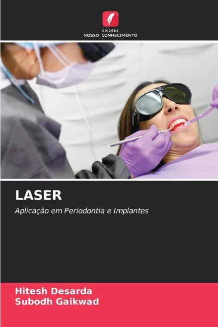 Laser - 9786208617288