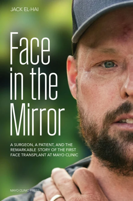Face in the Mirror: A Surgeon, a Patient, and the Remarkable Story of the First Face Transplant at Mayo Clinic
