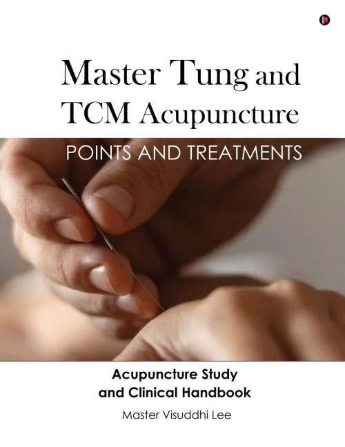 Master Tung and TCM Acupuncture: Points and Treatments - (Paperback or Softback)