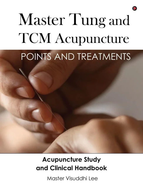 Master Tung and TCM Acupuncture: Points and Treatments - (Hardback or Cased Book)