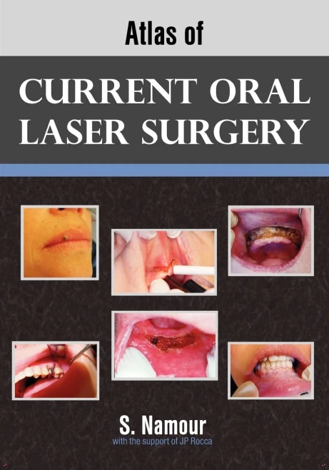 Atlas Of Current Oral Laser Surgery