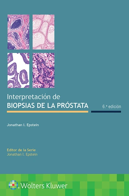 Interpretaci??N De Biopsias De La Pr??Stata (Spanish Edition)