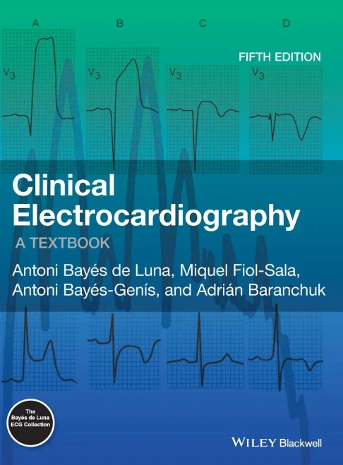 Clinical Electrocardiography: A Textbook