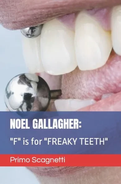 Noel Gallagher: ""F"" is for ""FREAKY TEETH""