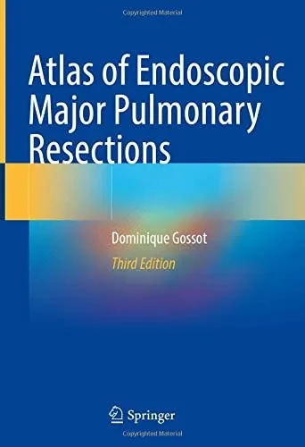 Atlas Of Endoscopic Major Pulmonary Resections