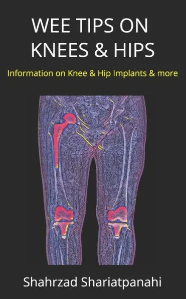 Wee Tips on Knees & Hips: Information on Knee & Hip Implants and More
