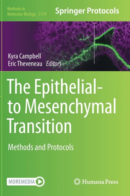 The Epithelial-to Mesenchymal Transition: Methods and Protocols (Methods in Molecular Biology, 2179)