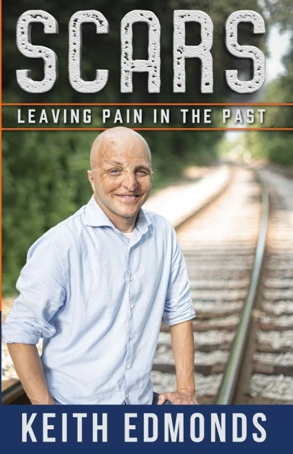 Scars : Leaving Pain In The Past