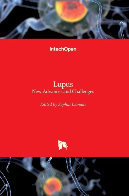 Lupus : New Advances and Challenges
