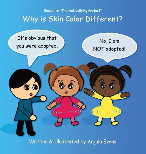 Why Is Skin Color Different? (Hardback)