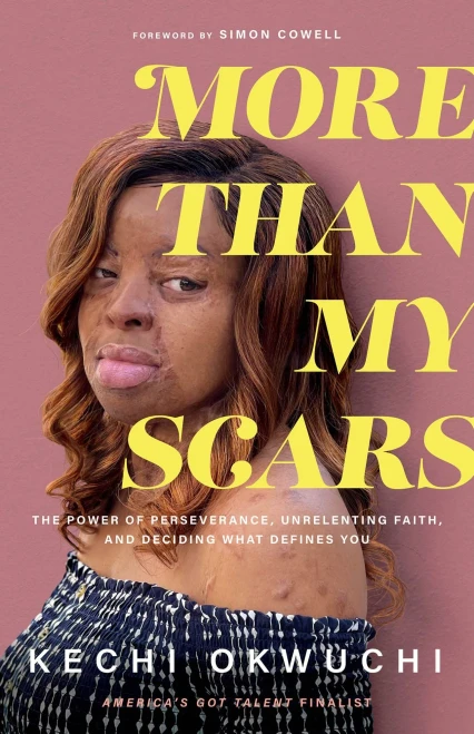 More Than My Scars - Paperback