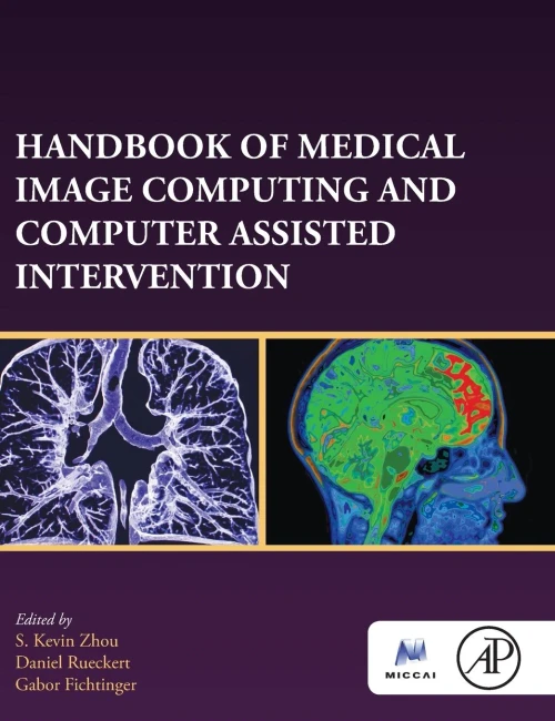 Handbook of Medical Image Computing and Computer Assisted Intervention (The MICCAI Society book Series)