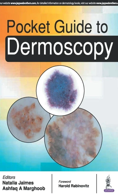 Dermoscopy Guide