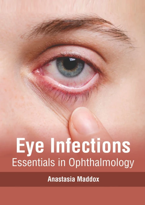 Eye Infections: Essentials In Ophthalmology