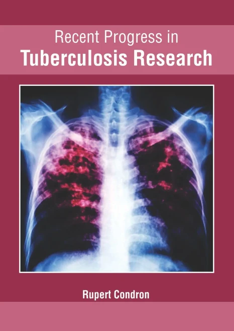 Recent Progress In Tuberculosis Research