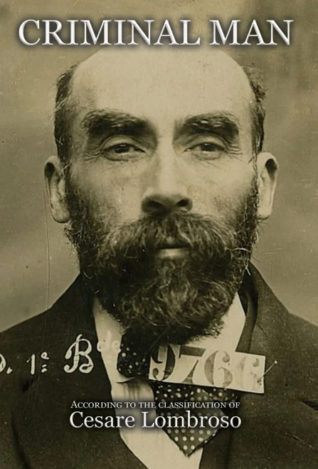 Criminal Man, According To The Classification Of Cesare Lombroso