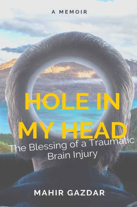 Hole In My Head: The Blessing Of A Traumatic Brain Injury