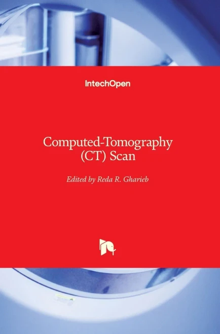 Computed-Tomography (Ct) Scan