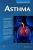 Asthma (MyModernHealth FAQs)