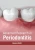 Advanced Research In Periodontitis