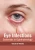 Eye Infections: Essentials In Ophthalmology