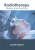 Radiotherapy: Theory And Practice