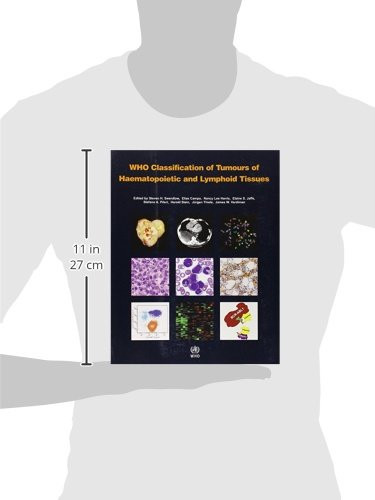 WHO Classification of Tumours of Haematopoietic and Lymphoid Tissue [OP ...
