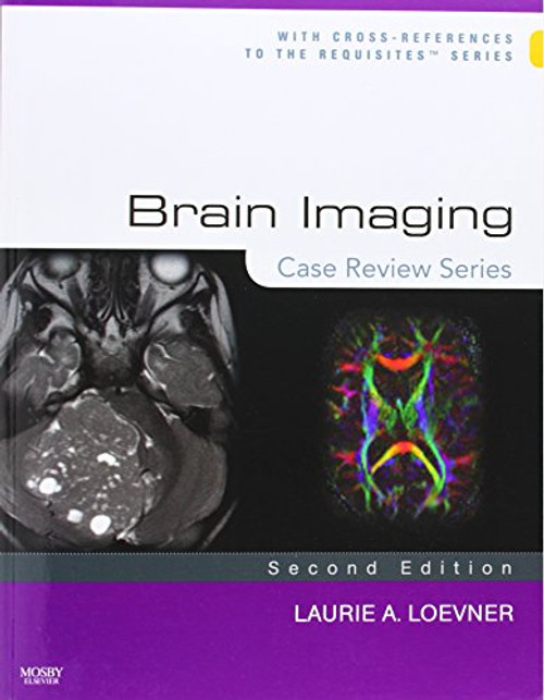 Brain Imaging: Case Review Series, 2e