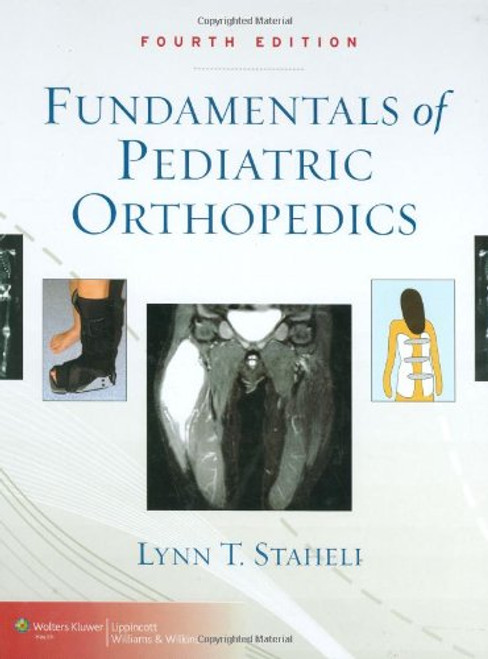 Fundamentals of Pediatric Orthopedics (Staheli, Fundamentals of Pediatric Orthopedics)