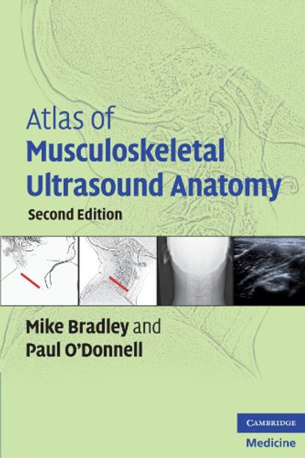 Atlas of Musculoskeletal Ultrasound Anatomy