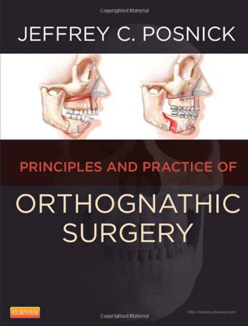 Orthognathic Surgery - 2 Volume Set: Principles and Practice, 1e