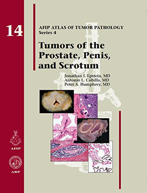 14: Tumors of the Prostate Gland, Seminal Vesicles, Penis, and Scrotum (AFIP Atlas of Tumor Pathology: Series 4)
