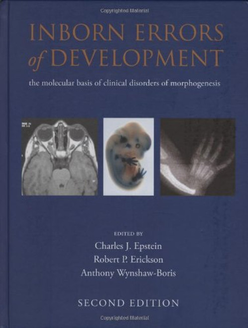 Inborn Errors of Development (Oxford Monographs on Medical Genetics) Inborn Errors of Development (Oxford Monographs on Medical Genetics)