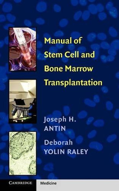 Manual of Stem Cell and Bone Marrow Transplantation (Cambridge Medicine (Paperback))