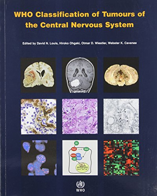 WHO Classification of Tumours of the Central Nervous System (IARC WHO Classification of Tumours) (v. 1) WHO Classification of Tumours of the Central Nervous System (IARC WHO Classification of Tumours) (v. 1)