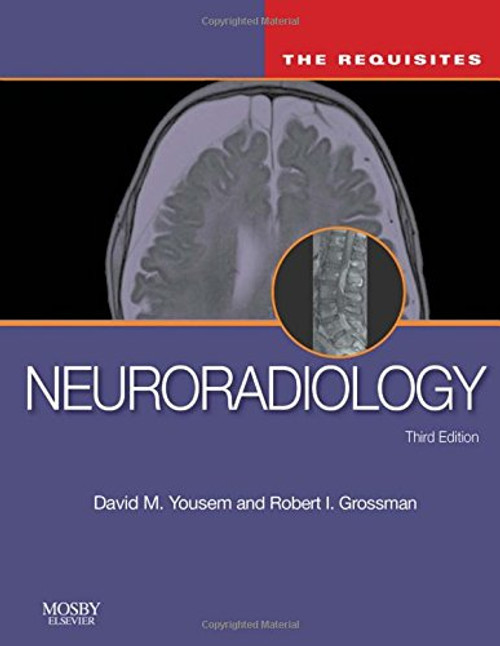 Neuroradiology: The Requisites, 3e (Requisites in Radiology) Neuroradiology: The Requisites, 3e (Requisites in Radiology)