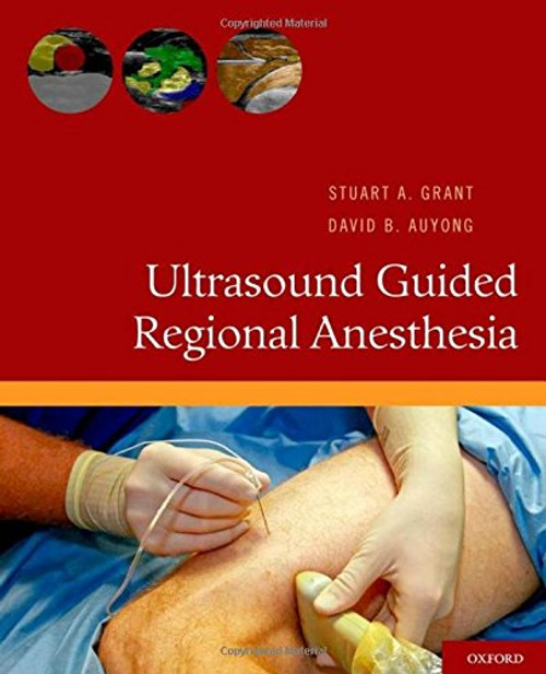 Ultrasound Guided Regional Anesthesia Ultrasound Guided Regional Anesthesia