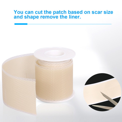 Adhesive Silicone Scar Patch Safety Mild Fade Scar Scar Reduction Therapy