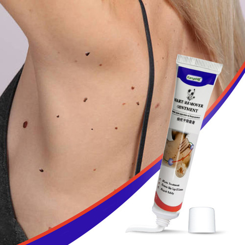 KanyeHB 20g Wart Remover Ointment Skin Tags Corns Remover Restore Safely Without Leaving Scars Refuse Rpeat