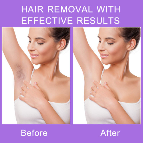 Laser Epilator Painless Hair Remover Bikini Trimmer USB Shaver Instant Depilation Tool For Face Arms Legs Beauty Health Care